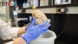 In this July 29, 2013 photo, a researcher holds a human brain in a laboratory at Northwestern University's cognitive neurology and Alzheimer's disease center in Chicago. (AP Photo/Scott Eisen)
