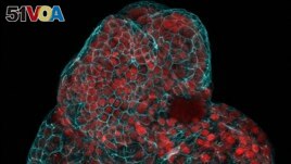 This microscope image provided by researchers in March 2024 shows a lung organoid created from cells collected from amniotic fluid. (Giuseppe Cal<I>&#</I>224;, Paolo De Coppi, Mattia Gerli via AP)