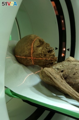 Hungarian mummies have more tissue intact for research purposes.