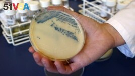 FILE This Oct. 12, 2009 photo shows a petri dish with MSRA cultures at the Queen Elizabeth Hospital in King's Lynn, England.