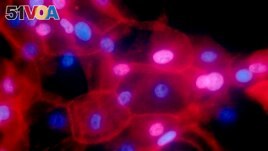 FILE - This undated fluorescence-colored microscope image made available by the National Institutes of Health in September 2016 shows a culture of human breast cancer cells. (Ewa Krawczyk/National Cancer Institute via AP)