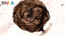 A multicellular fungus named Ourasphaira giraldae, which lived roughly 900 million to 1 billion years ago. is shown in this photograph from the University of Liege, Belgium released May 22, 2019. 