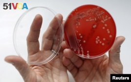 Blue and green clay might be able to kill MRSA (Methicillin-resistant Staphylococcus aureus). MRSA is an antibiotic resistant bacteria, sometimes called a superbug. (REUTERS)