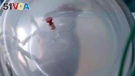 A premature lamb fetus is seen inside an artificial womb developed by researchers from BCNatal in Barcelona, Spain, in this screen grab from a video released on June 19, 2023 and obtained by Reuters on June 29, 2023. (La Caixa Foundation/Handout via REUTERS)