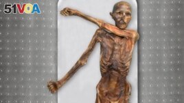 FILE - This photo provided by The South Tyrol Museum of Archaeology shows Oetzi the Iceman, one of the oldest human glacier mummies. (Marco Samadelli, Gregor Staschitz/South Tyrol Museum of Archaeology/EURAC via AP)