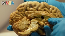 A developing brain can be damaged by unkind words, a study shows. (FILE PHOTO)