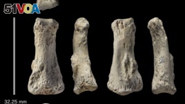 The single fossil finger bone of Homo sapiens - pictured from various angles - from the Al Wusta site, Saudi Arabia is pictured in this undated handout composite April 9, 2018. (Ian Cartwright/Handout via REUTERS)