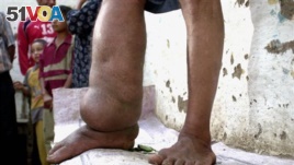 Treated Bed Nets Critical to Stopping lymphatic Filariasis