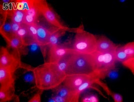 FILE - This undated fluorescence-colored microscope image made available by the National Institutes of Health in September 2016 shows a culture of human breast cancer cells.