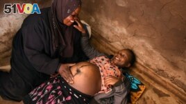 Lucy Mbewe, a traditional birth attendant attends to a pregnant woman at her home, in Simika Village, Chiradzulu, southern Malawi on Sunday, May 23, 2021. 