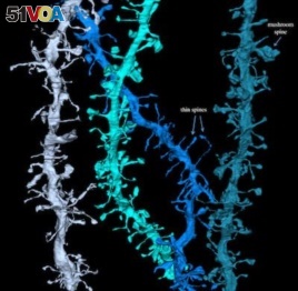 These are images of synapses that shrink during sleep. Read the article to find out why that is a good thing. (Photo Credit: Wisconsin Center for Sleep and Consciousness)