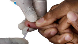 Pins are sharp and can hurt. Like when you get a pin prick for a blood test. Today we talk about an English expression that uses this sharp but useful object. 