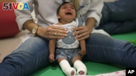 Luana Vitoria, who was born with microcephaly, cries during a physical therapy session at the Altino Ventura Foundation, a treatment center that provides free health care in Recife, Brazil, in this Feb. 4, 2016 photo. (AP Photo/Felipe Dana)