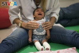 In this Feb. 4, 2016 photo, Luana Vitoria, who was born with microcephaly, cries during a physical therapy session at a treatment center in Racife, Brazil. (AP Photo)