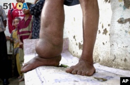 Can Treated Mosquito Net Stop Elephantiasis?