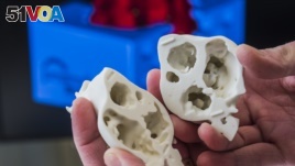3-D Printing Adds New Dimension to Heart Surgery