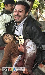 A wounded Palestinian child being carried to the Shifa Hospital in Gaza City, 05 Jan 2009
