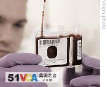 Cord blood sample