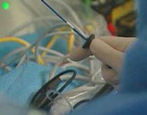 Doctor David Wilber performs a catheter ablation at Loyola University Medical Center in Illinois