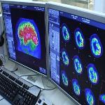 Brain Scans Find Consciousness in Some Vegetative Patients 