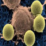 'Serial Killer' Cells Demolish Leukemia Tumors